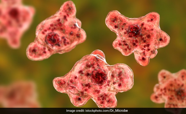 Brain-Eating Amoeba Kills Pak Man After He Went Swimming: Report