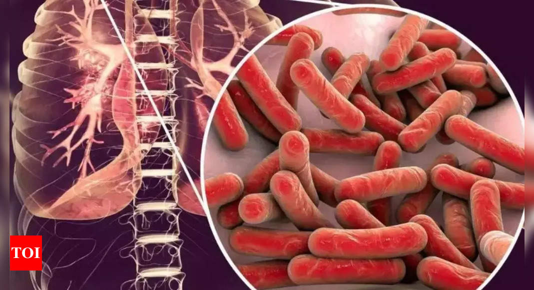 Healthcare workers at higher risk of Tuberculosis than general population: Study